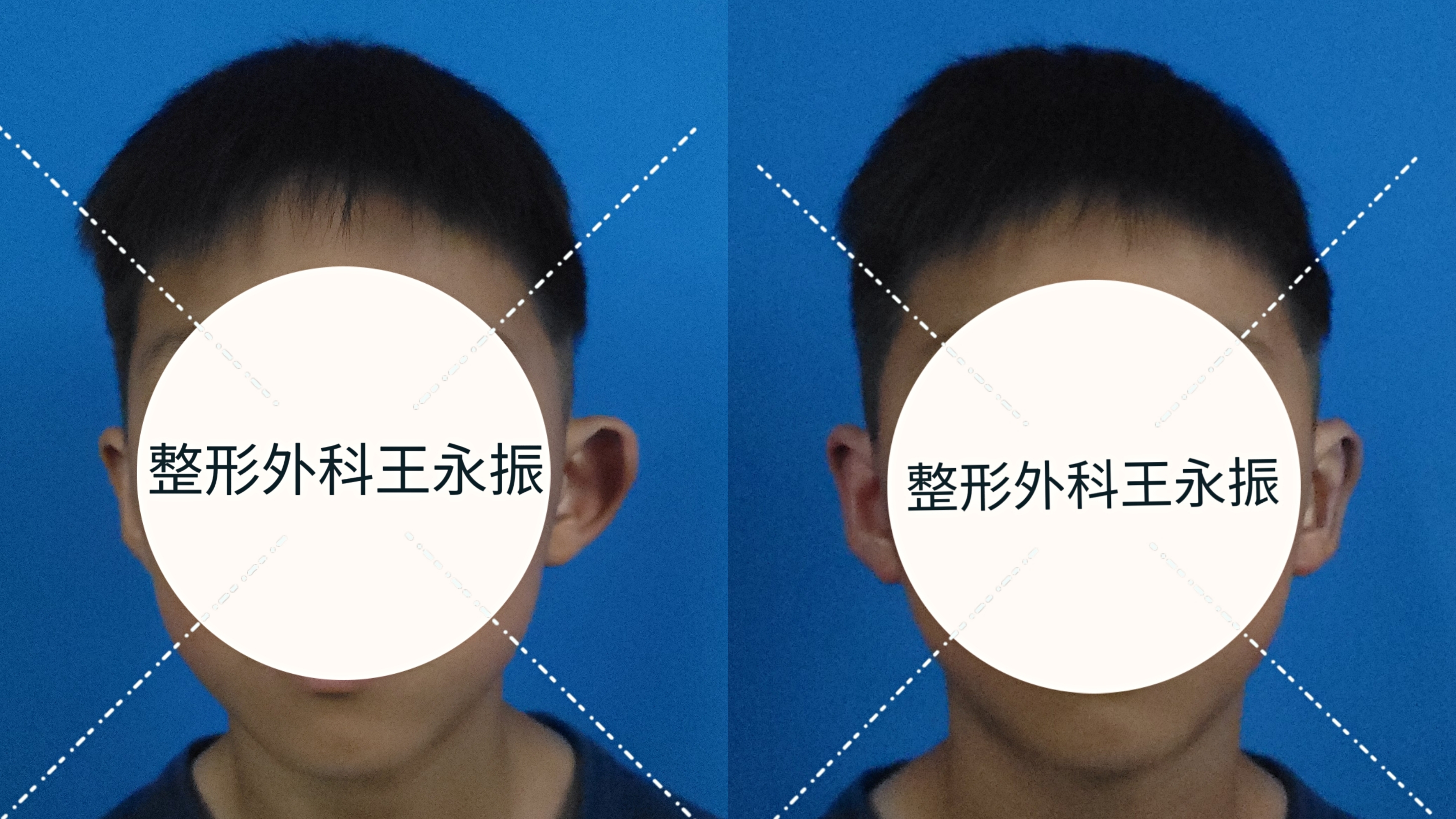 圖文圖片