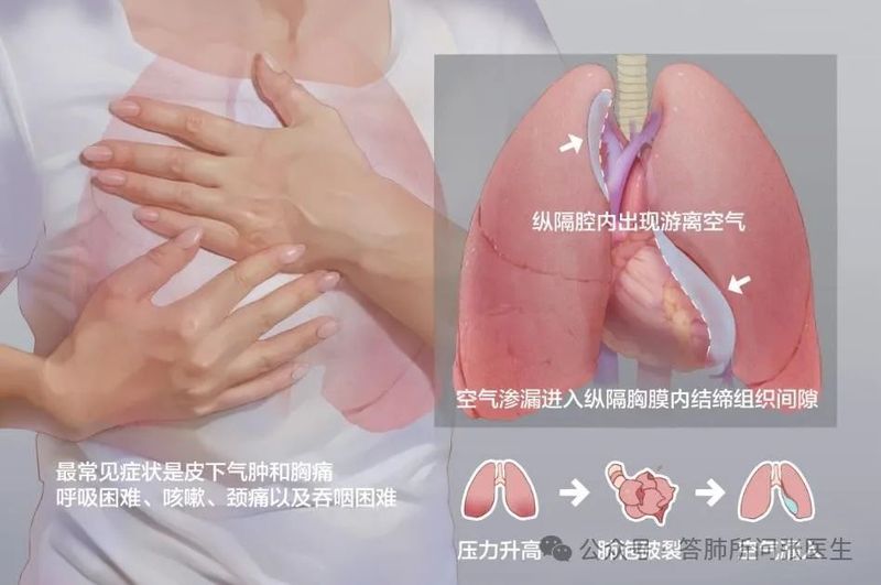 圖文圖片