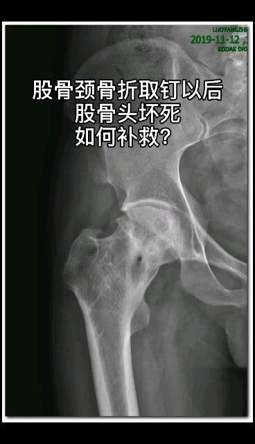 視頻封面
