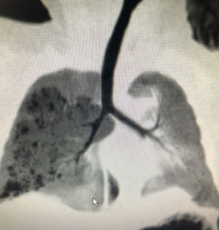 1593957643849565.png image.png