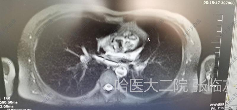 圖文圖片