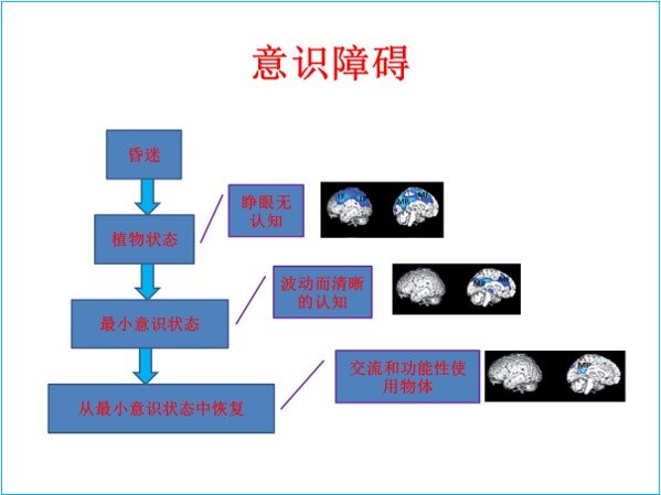 意识障碍.jpg