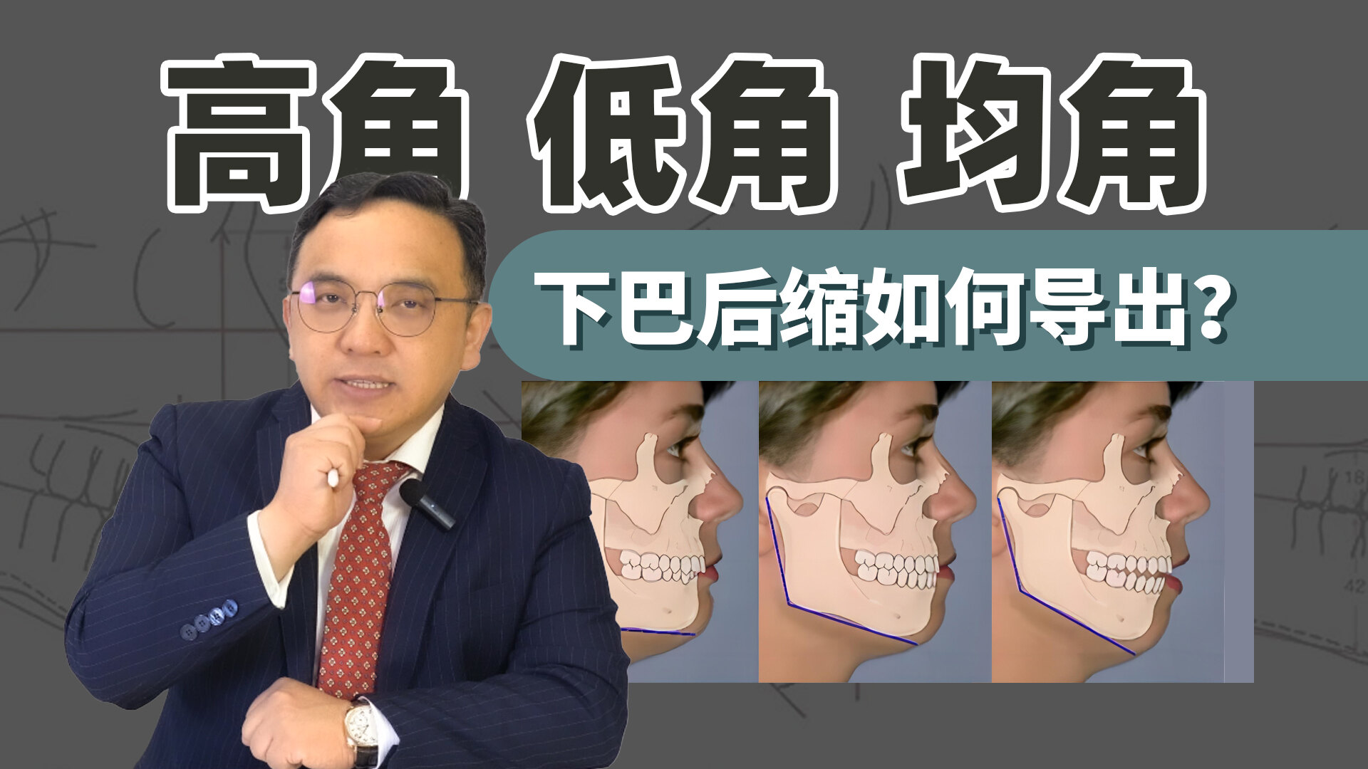 圖文圖片