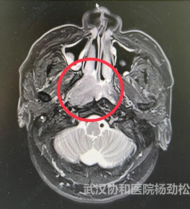 圖文圖片
