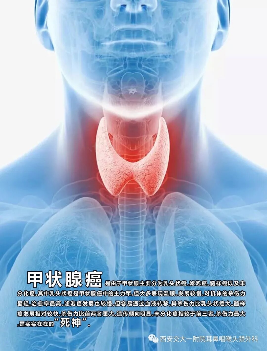 甲状腺癌_介绍_如何预防_治疗方式_日常注意事项 - 好大夫在线