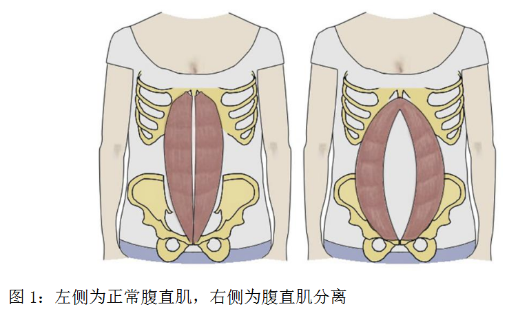 腹白线位置图图片