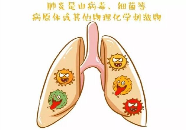 社区获得性肺炎和医院感染性肺炎如何经验性使用抗生素?