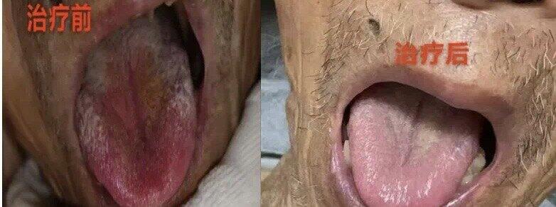 圖文圖片