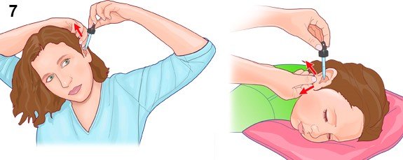 耳浴的正确方法