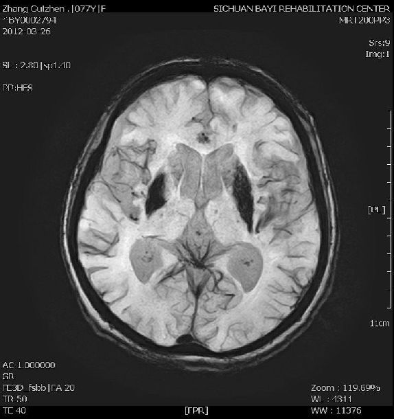 磁共振成像(mri)檢查項目及特色 - 好大夫在線