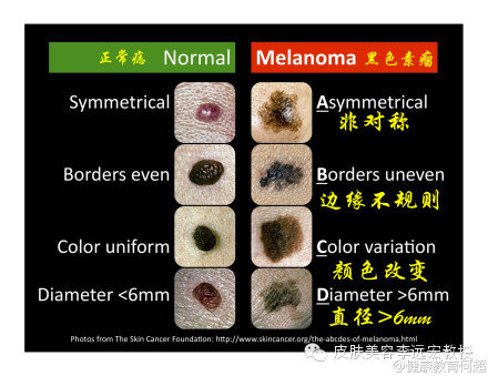 黑色美甲图片大全2013图片_黑色马犬图片大全图片_黑色素瘤能治愈吗图片大全