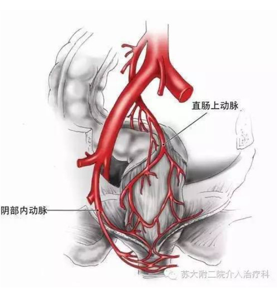 直腸周圍的動脈血供3圖示:pph治療痔瘡手術過程最近的一些治療已經