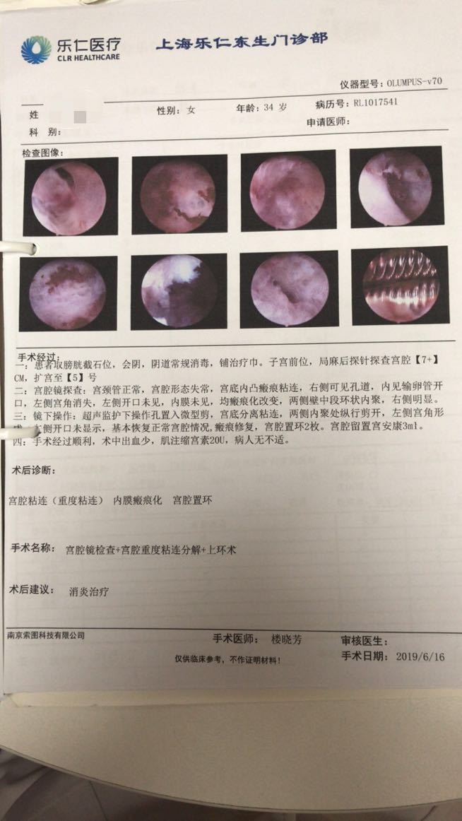 子宫内膜增生宫腔镜图片