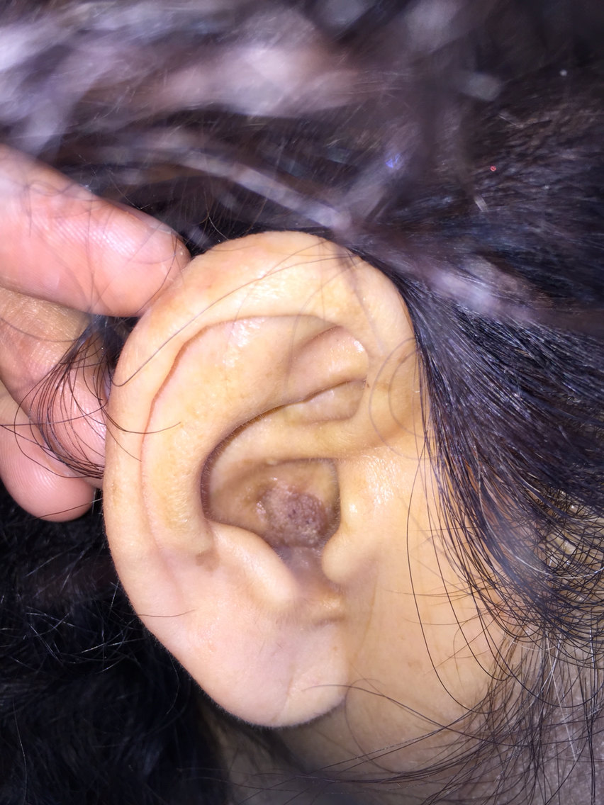 养成捅肚脐抠鼻子掏耳朵的坏毛病会出问题的