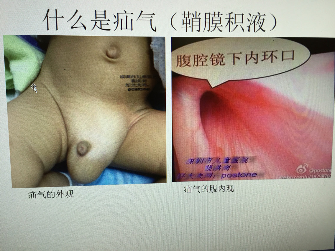 暂无