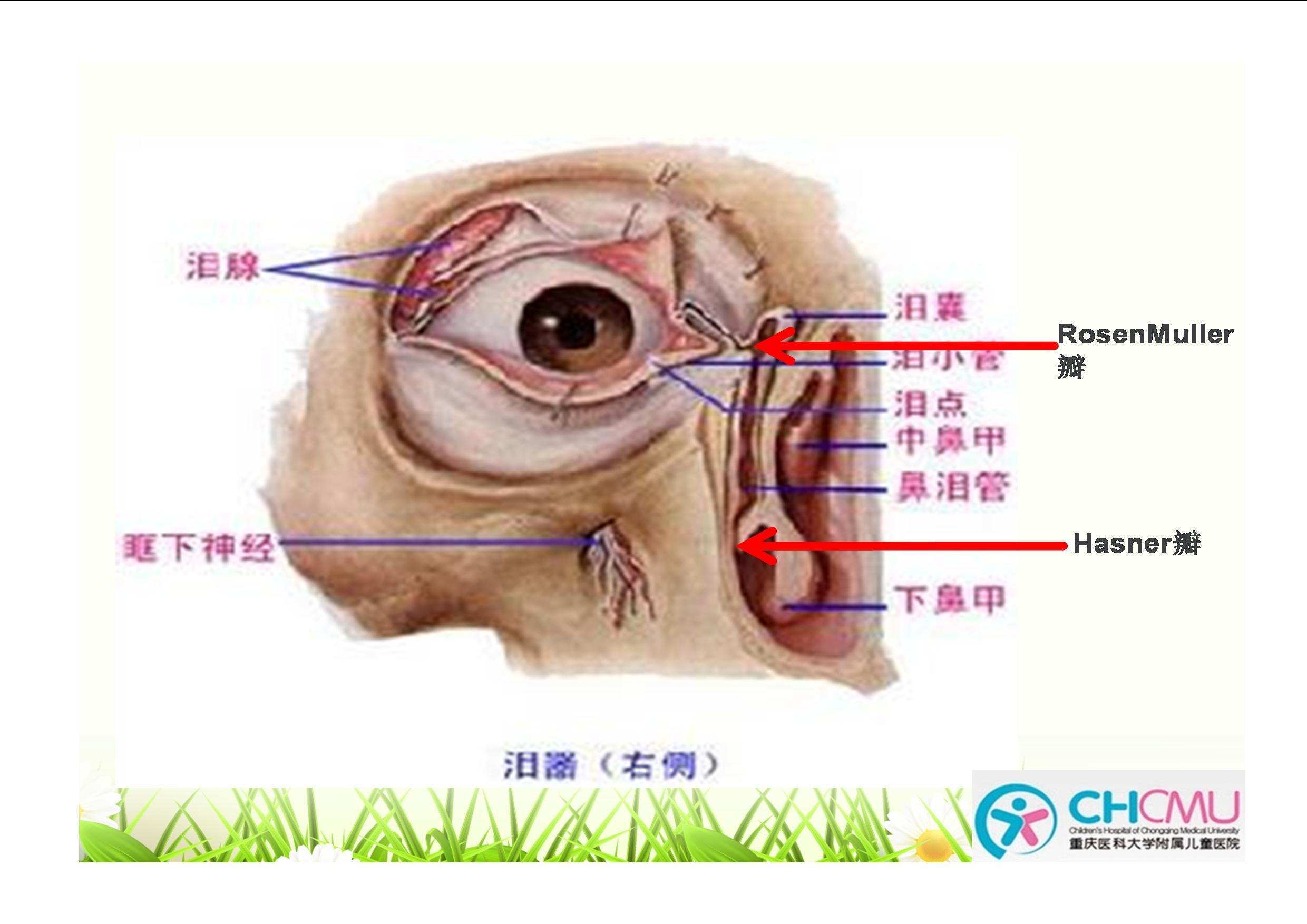 位于鼻泪管末端的hasner瓣膜未破裂和位于泪总管开口处的rosenmuller