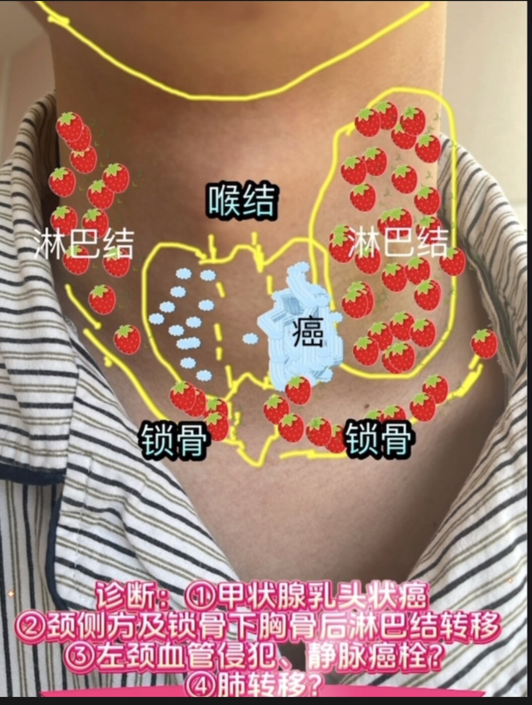 圖文圖片