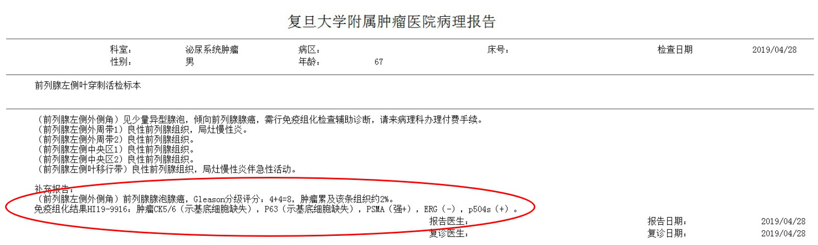前列腺精准穿刺靶向穿刺实际案例分析一