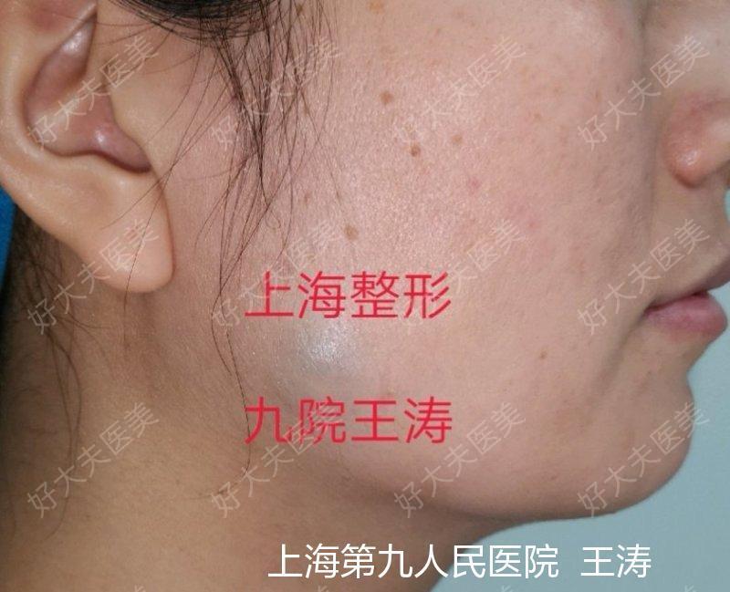 圖文圖片