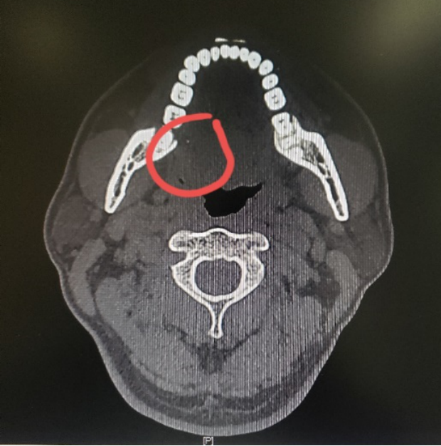 1578981700533761.png 图片5.png