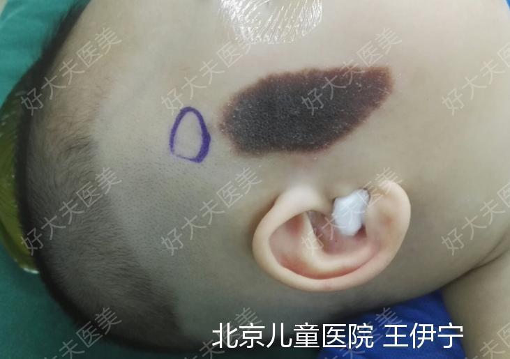 圖文圖片