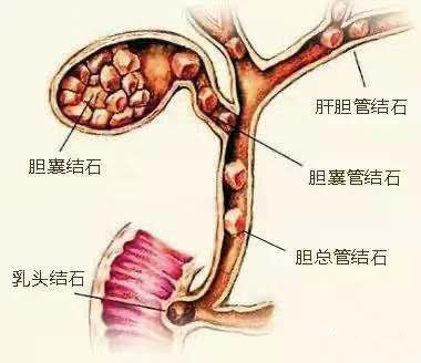 首先,我们都知道胆汁是由肝脏产生的,胆囊只是胆汁的储存器官,肝脏