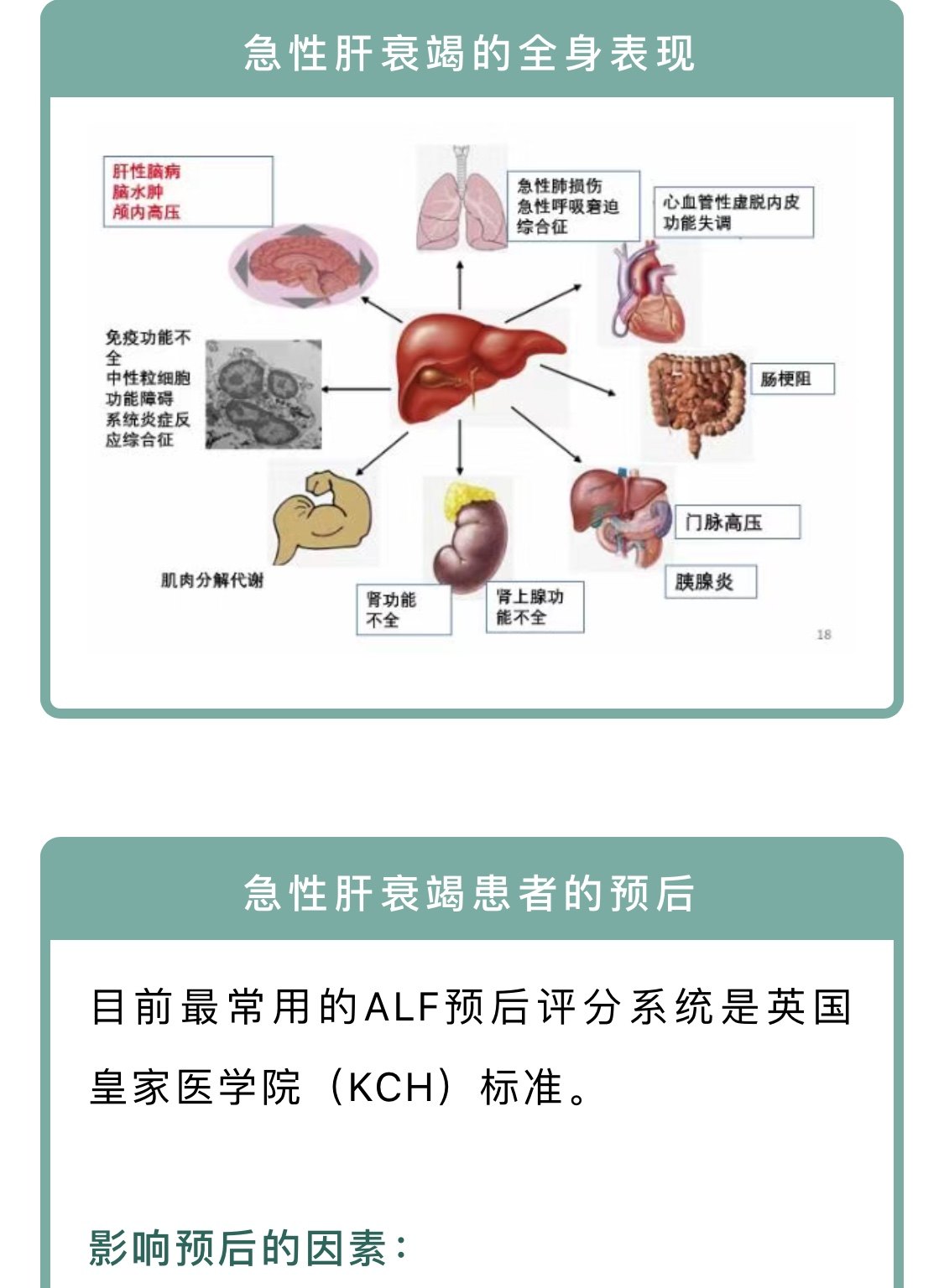 孟慶華教授:急性肝衰竭的激素應用和營養支持 - 好大夫在線