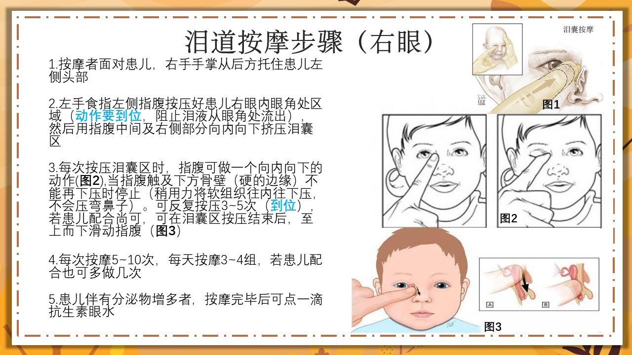 先天性泪道阻塞、泪道按摩的几件事_泪道阻塞_症状表现_检查_治疗方式 - 好大夫在线