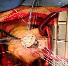 1574391792491059.png image.png