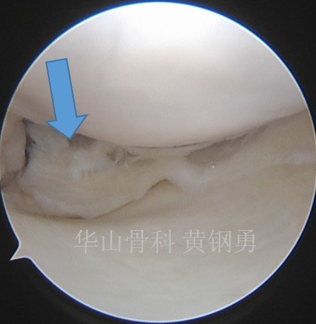 暂无