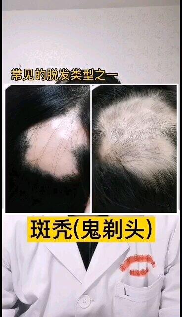 視頻封面