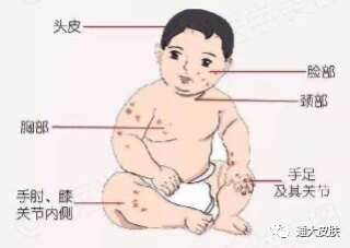 圖文圖片