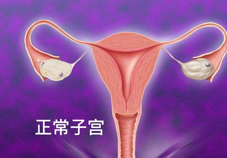 子宫粘膜下肌瘤ii型的宫腔镜手术治疗
