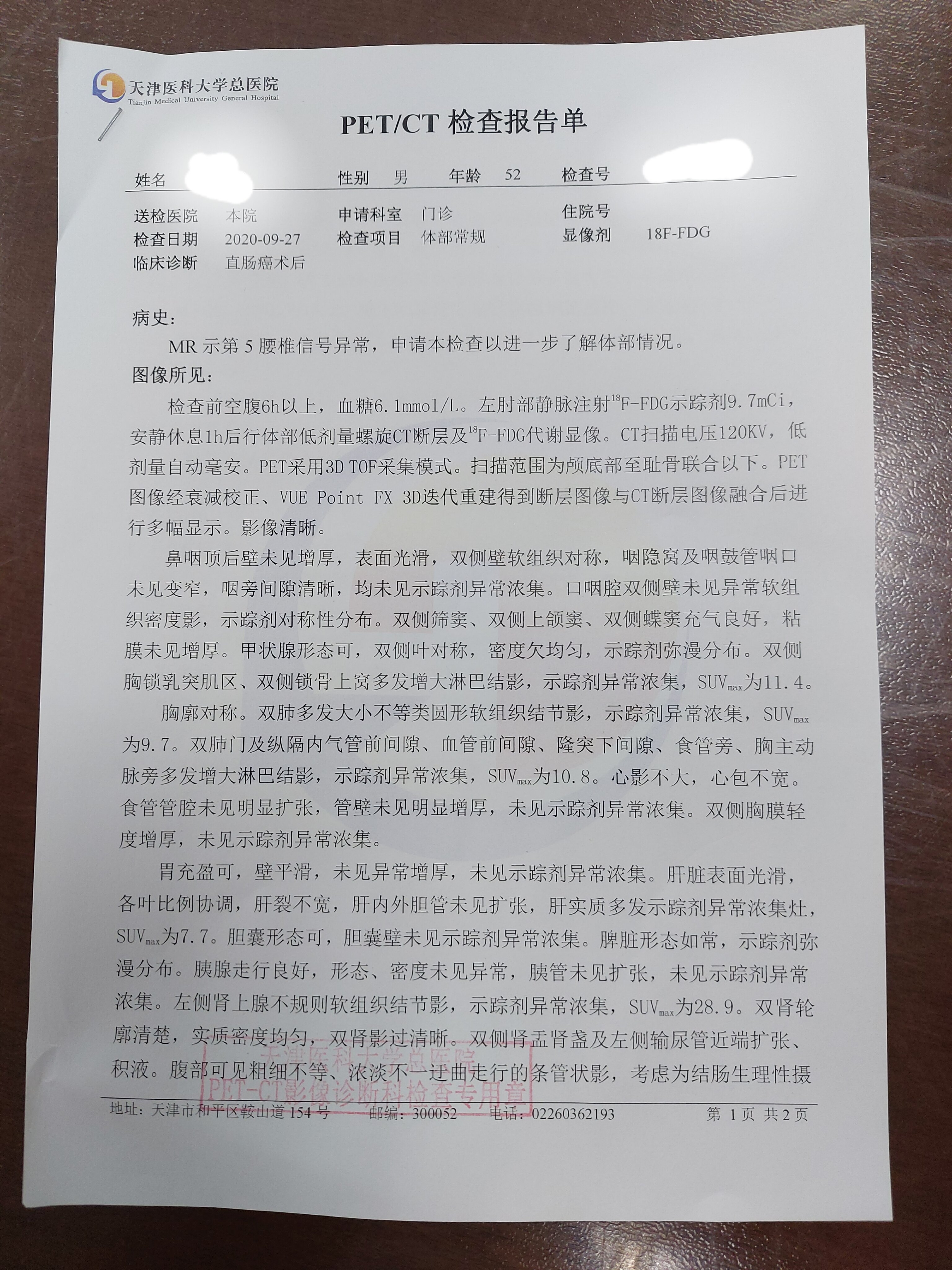 刘懿博士说肺癌一亖三二直肠癌术后包括肺在内都转移还能手术吗