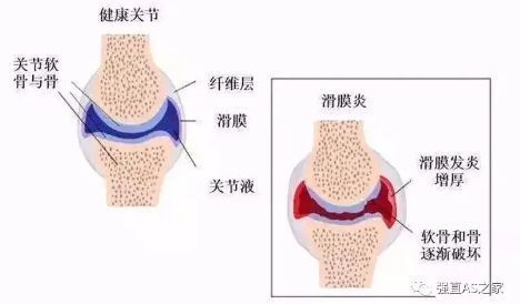 圖文圖片
