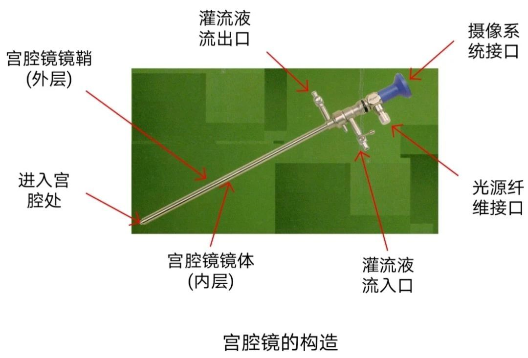 宫腔镜检查步骤图片