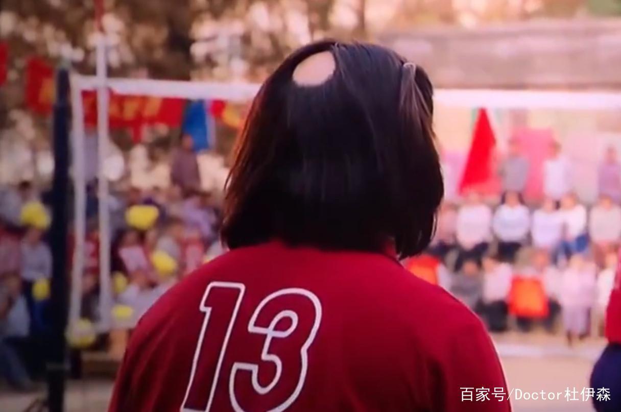 ",有些人甚至在理发时意外发现,此病发生诡异,因此民间俗称为"鬼剃头"