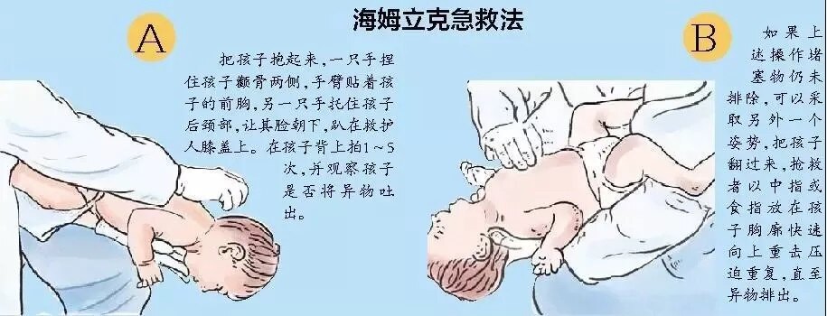 一岁以下孩子海姆立克急救法如果3岁以上的孩子发生意外,可以采用站立