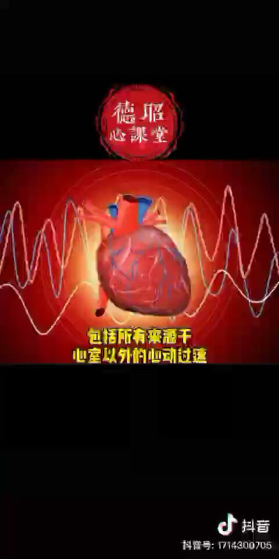 室上性心动过速