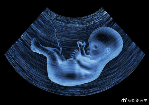 单脐动脉宝宝图片图片