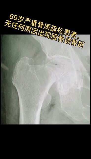 視頻封面