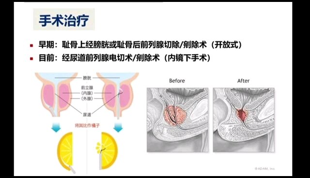 默认图片