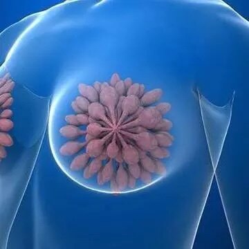 雄激素分泌水平低也会导致男性胸大吗 男性乳房肥大 男性乳房肥大