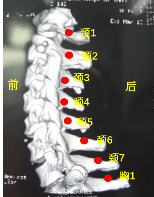 颈椎棘突的定位图图片