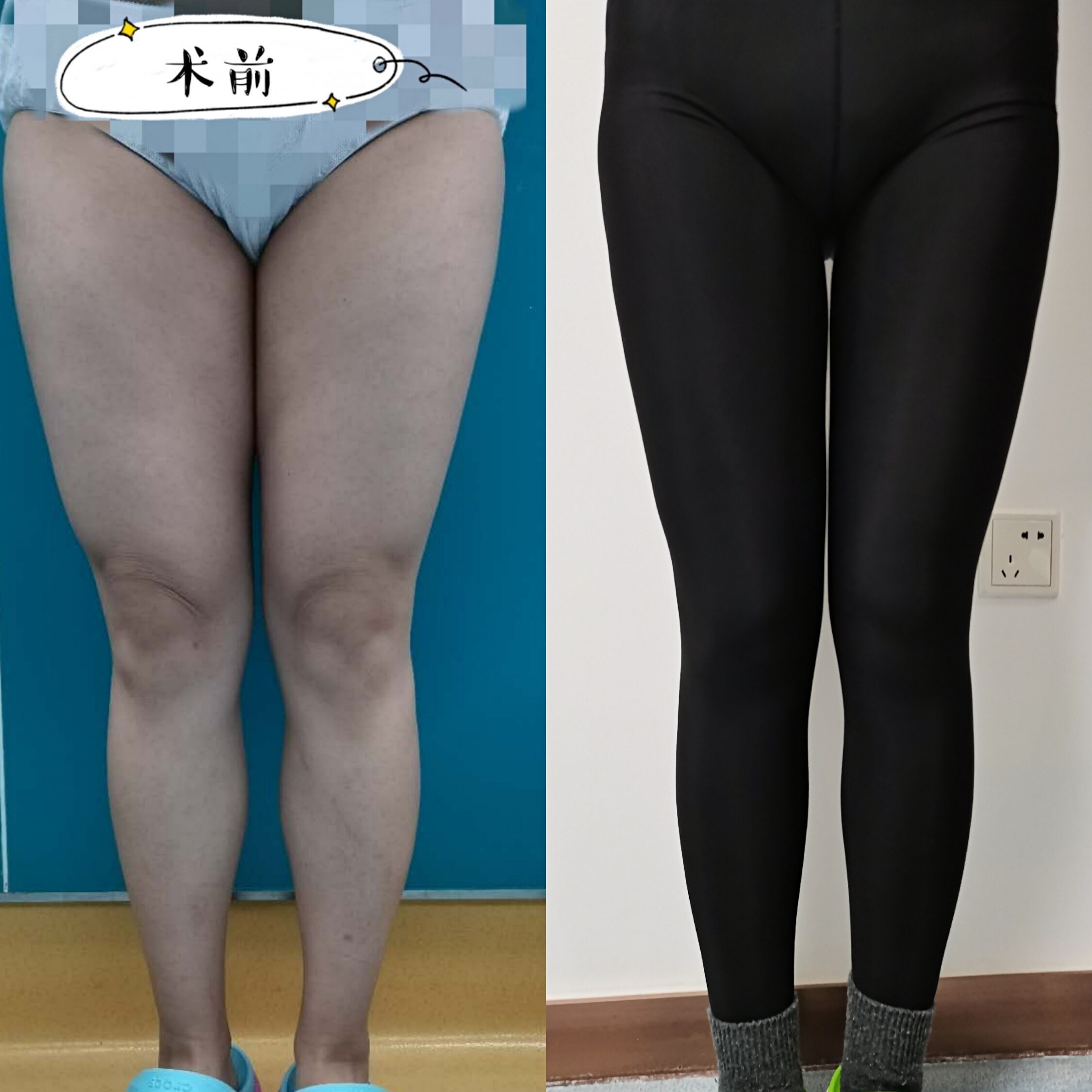 暂无