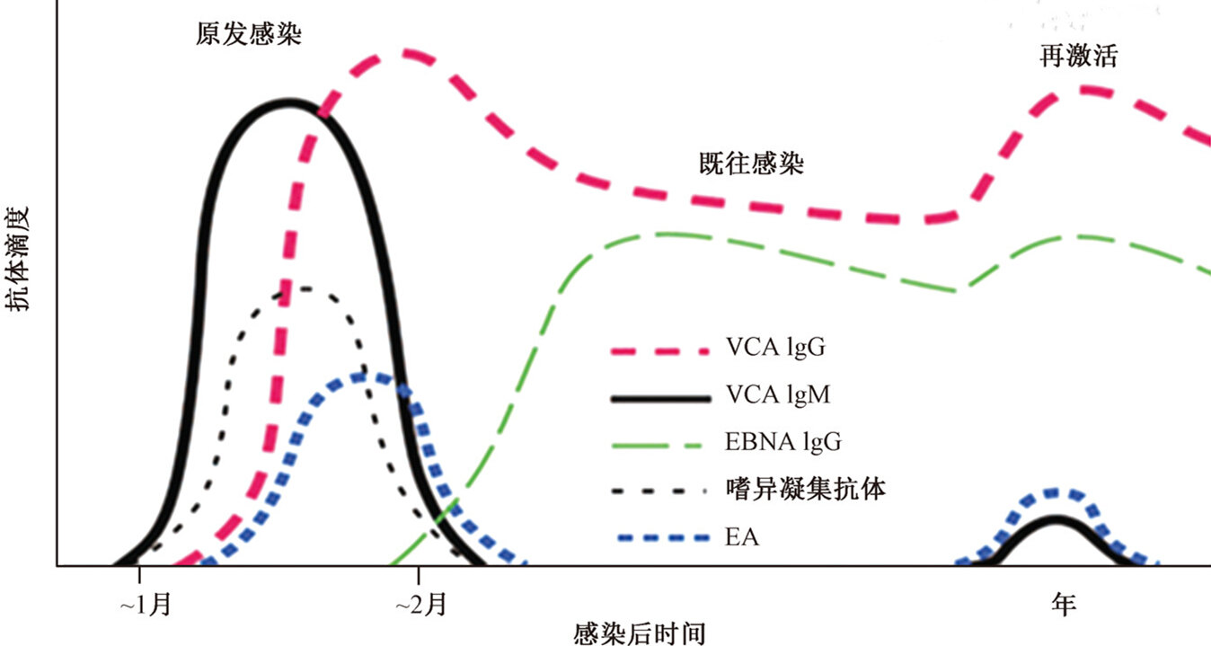 EB病毒感染诊断_EB病毒感染_介绍_检查- 好大夫在线