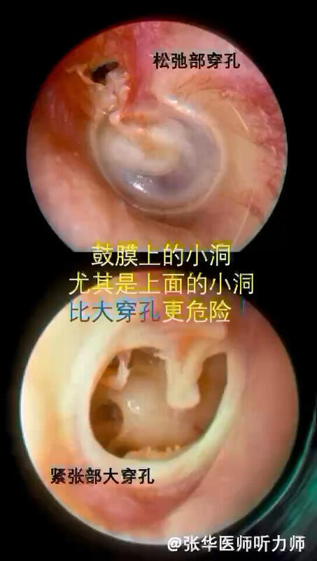 視頻封面