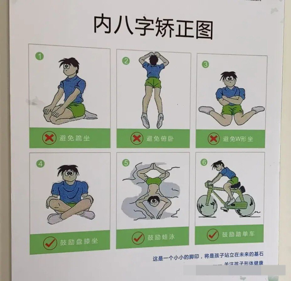 行走后跑步时易摔跤者,可短期使用内八字矫正鞋