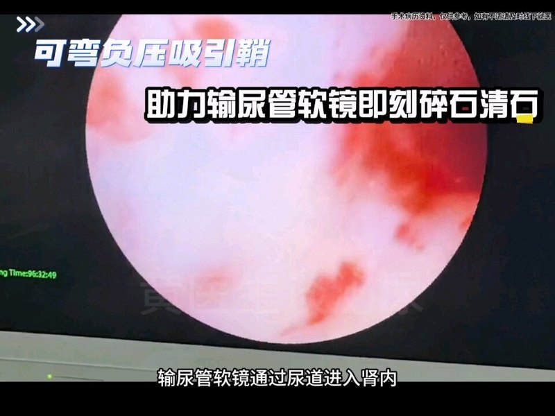 視頻封面