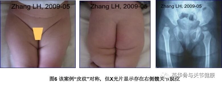 暂无